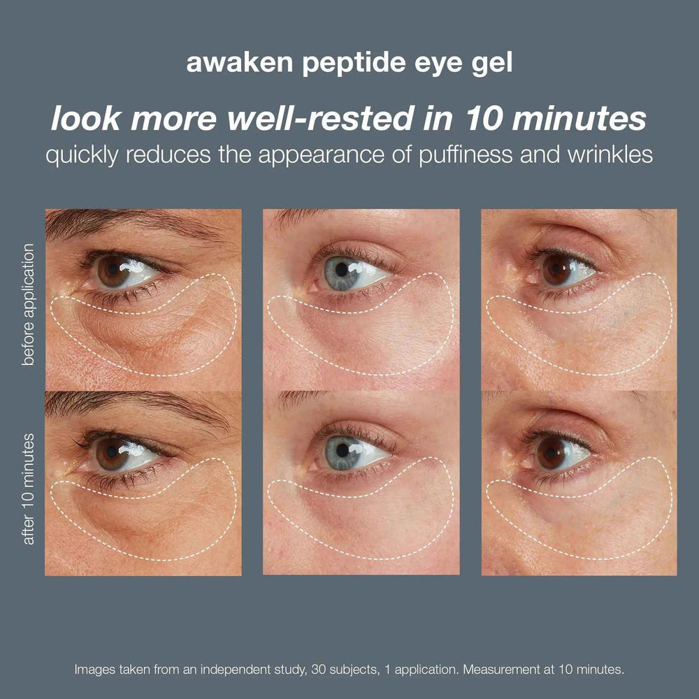 Advertisement for dermalogica awaken peptide eye gel showing before and after effects on eye area.