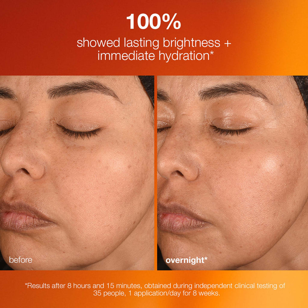 Before and after comparison of a woman's face with text about Dermalogica biolumin-c night restore effectiveness.
