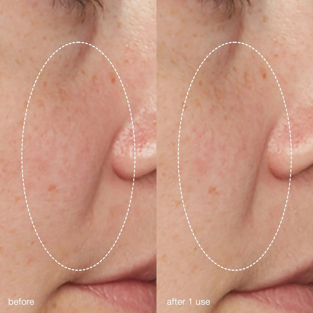 Before and after comparison of skin treatment with dermalogica liquid peelfoliant on a person's face.